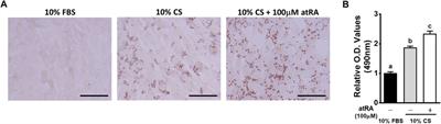 Transdifferentiation of Myoblasts Into Adipocytes by All-Trans-Retinoic Acid in Avian